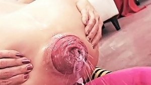 Extreme Anal Gape Huge Prolapse Inserting Milk And